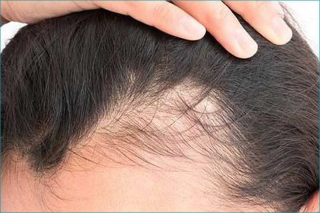 stempiatura fisiologica