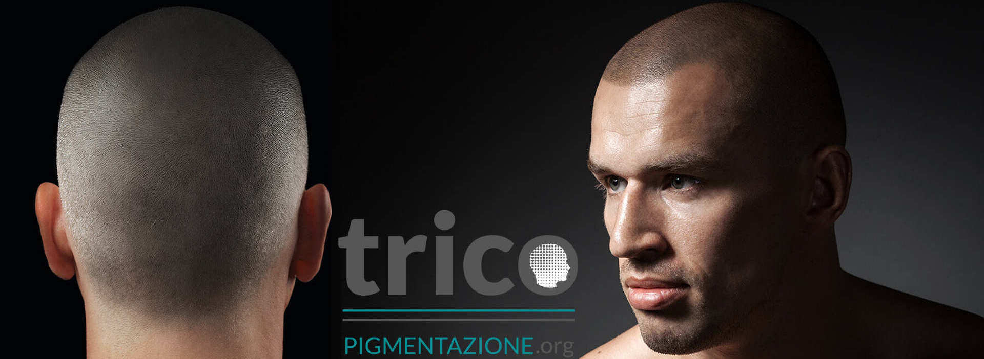 tricopigmentazione